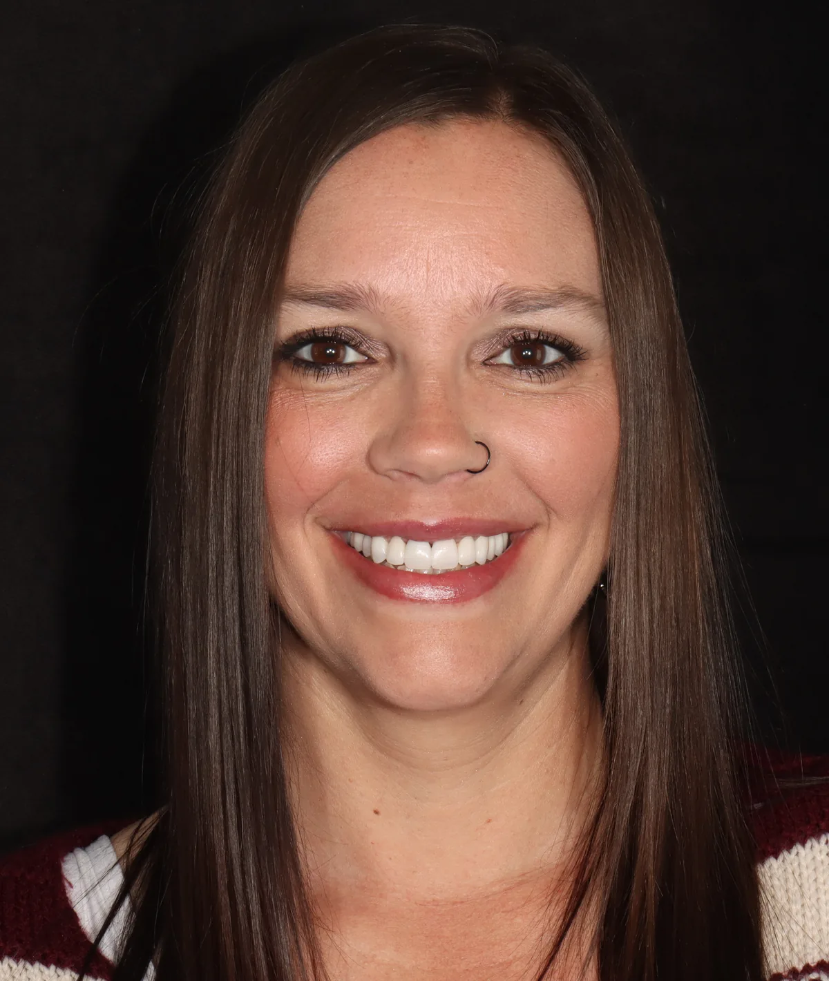 After — Edwina — Smile Transformation