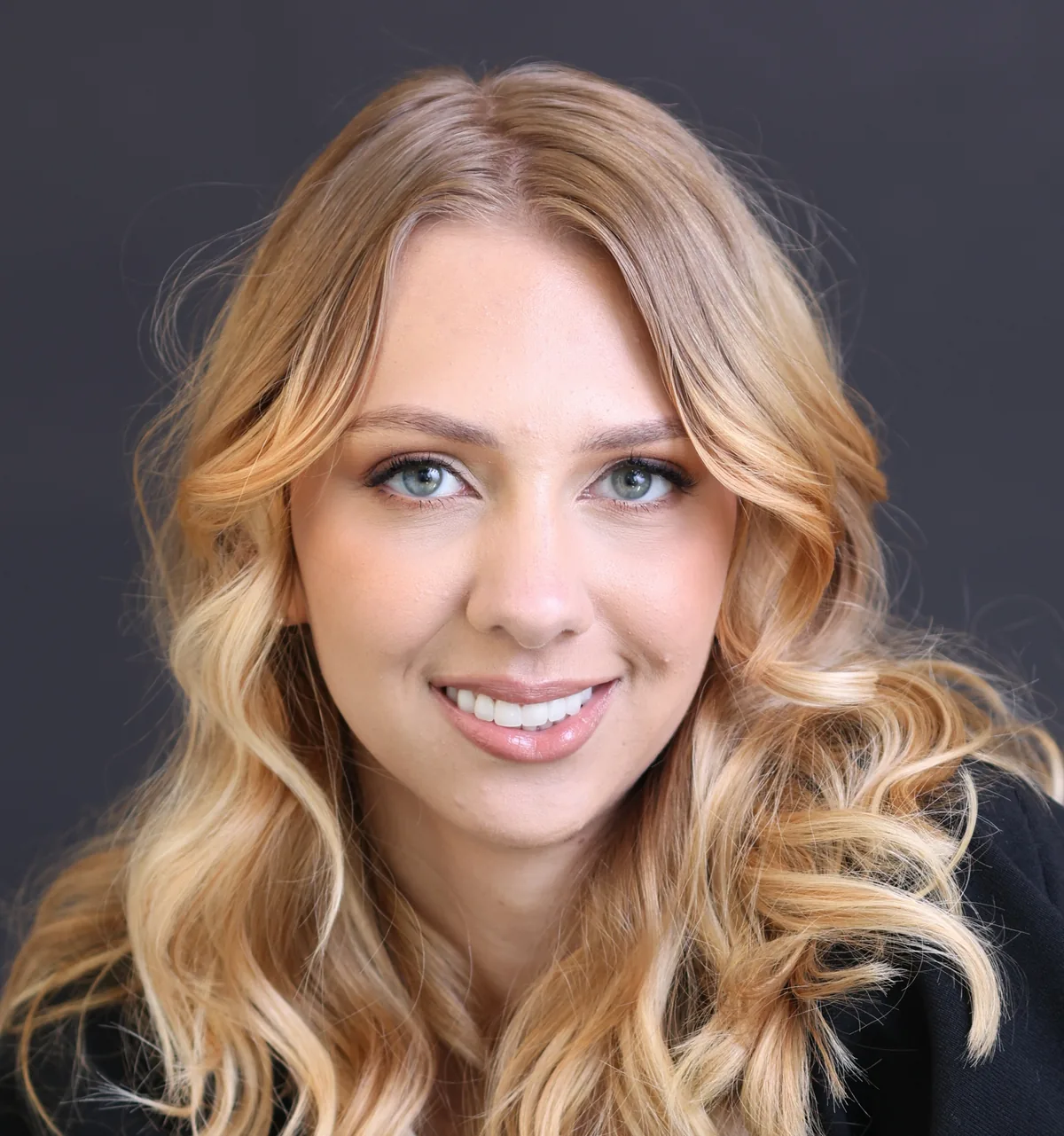 After — Freya — Cosmetic Restoration